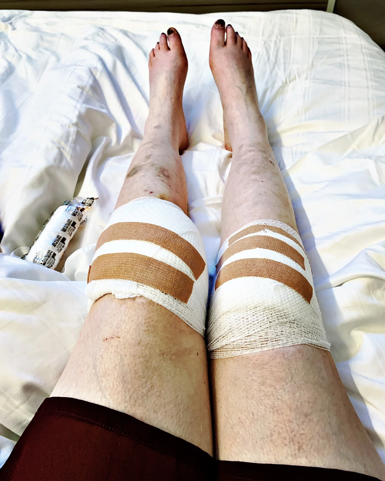 The 12th &amp; 13th; Smashed both knees into the tarmac.