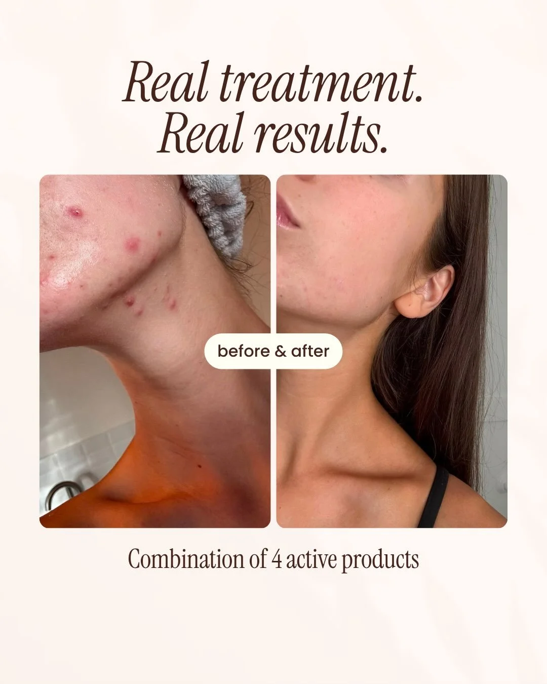 Hero products for combination, oily and acne prone skin 💗
Receive a free face scrub this month when you spend $60!

www.florasbare.com

#globalbeautyawards2026
#madeincanada