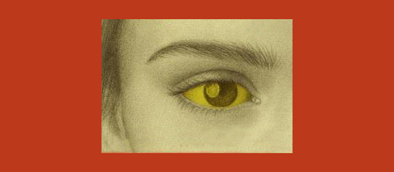 yellow fever 1793 eyes
