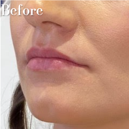 Screenshot 2026-03-16 114452.png