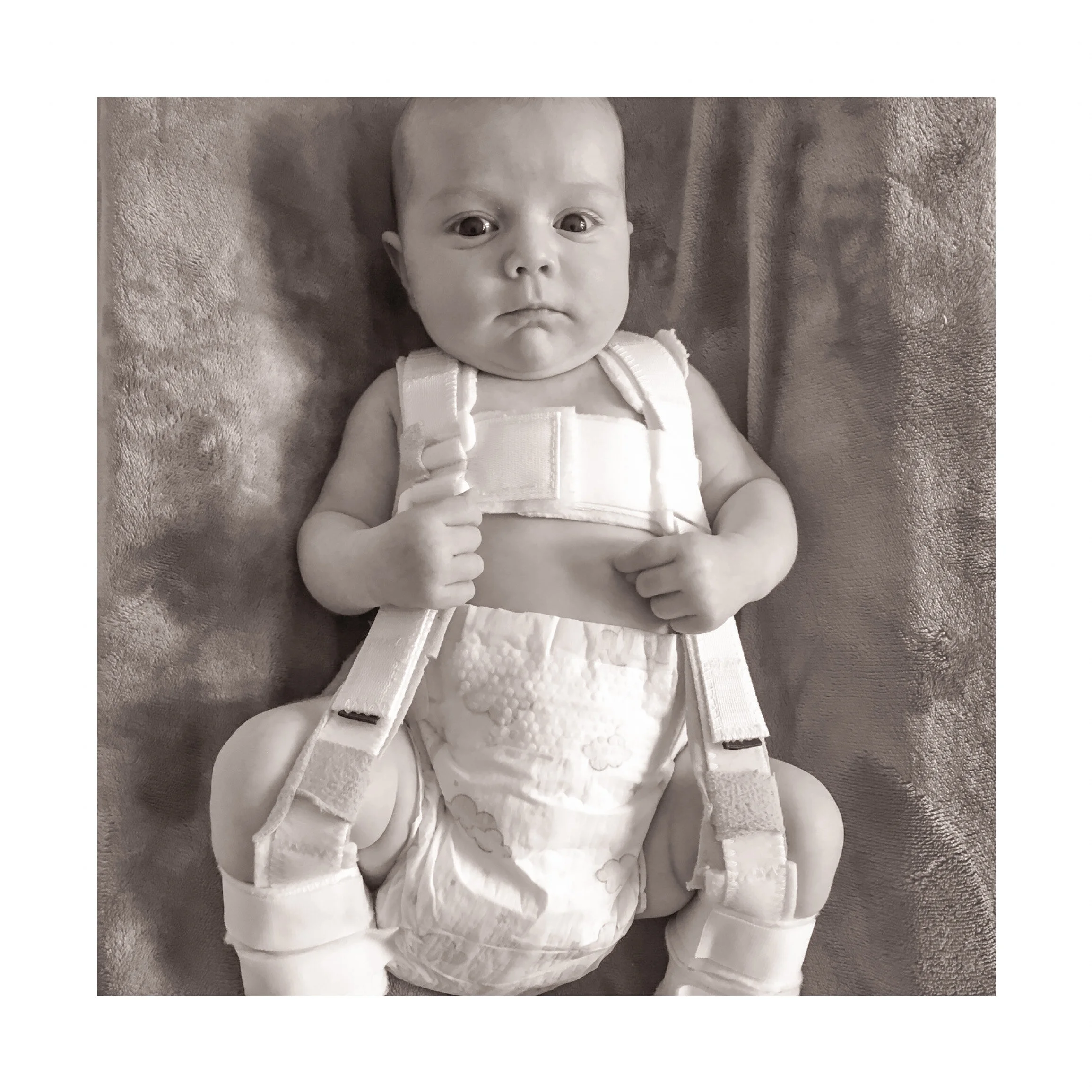 My Strong Little Journey: Emma &amp; Georgina- Hip Dysplasia