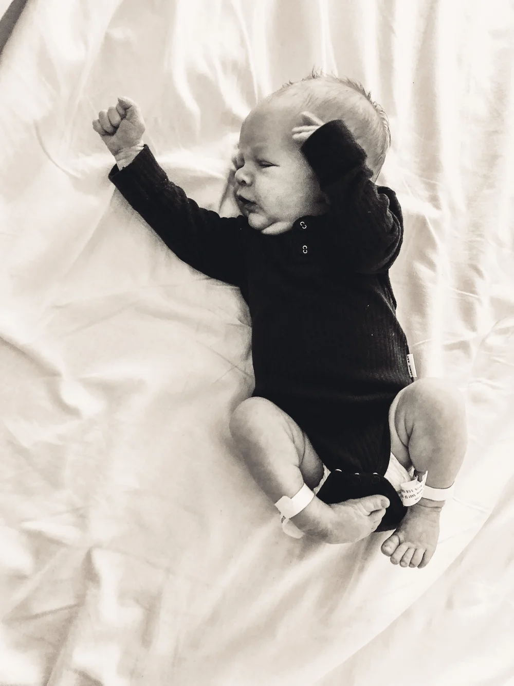 My Strong Little Journey Erin And Jackson Club Foot My Strong Little Body