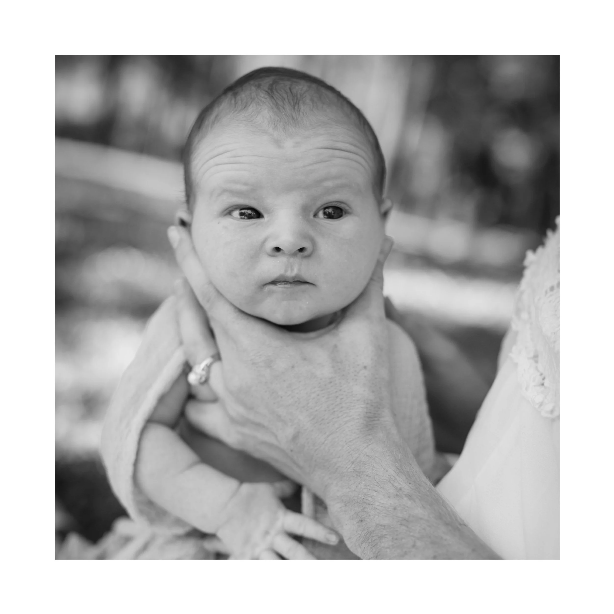 How to recognise plagiocephaly or a 'flat head' in your baby and what to do about it.