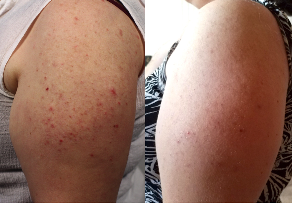 Maria's Six-Week Progress