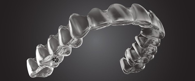 invisalign.jpeg
