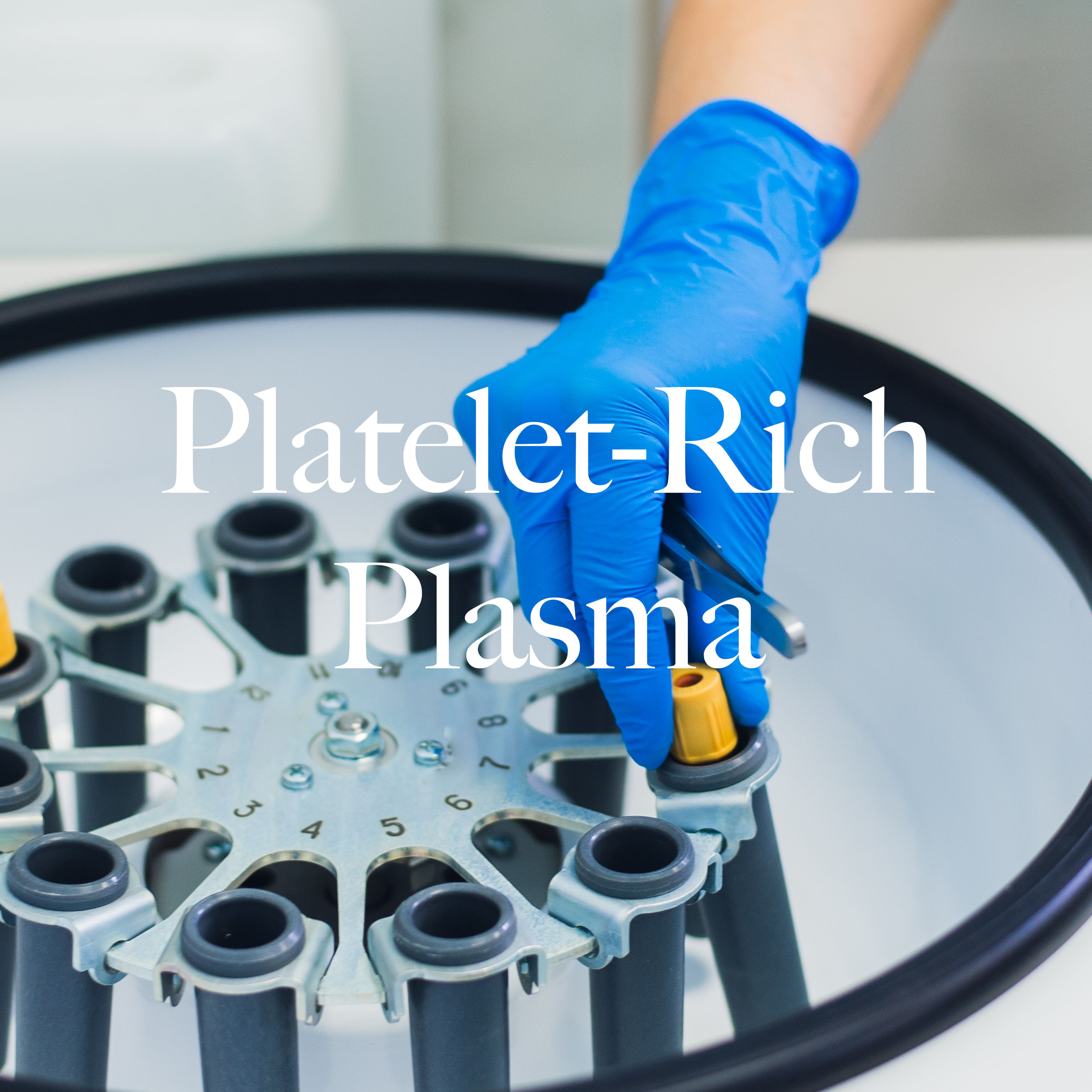 platelet-richplasma 2.jpg