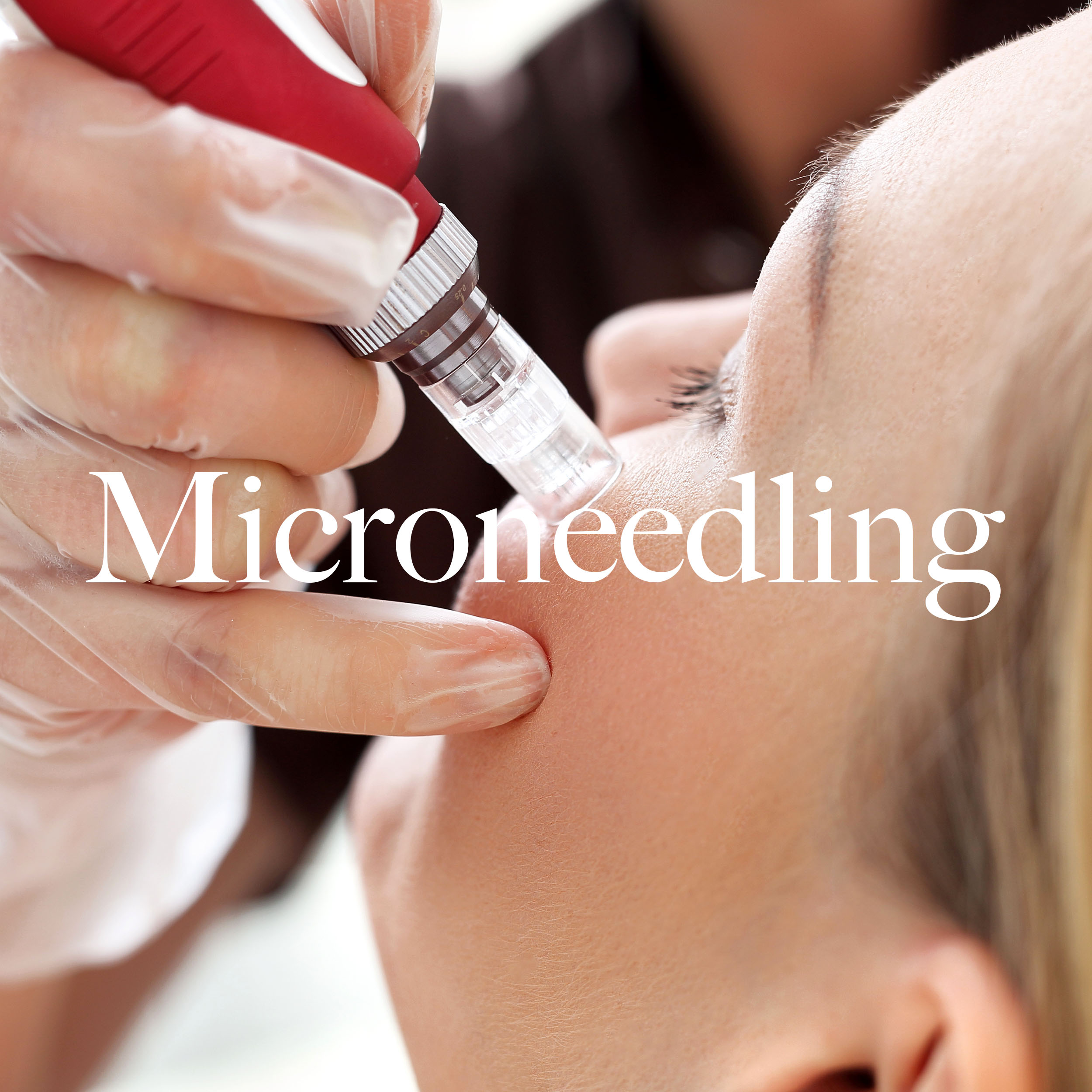 microneedling copy.jpg