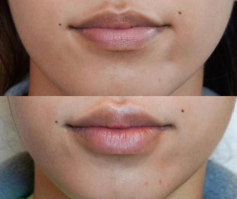 What Kylie Jenner has done for my Business