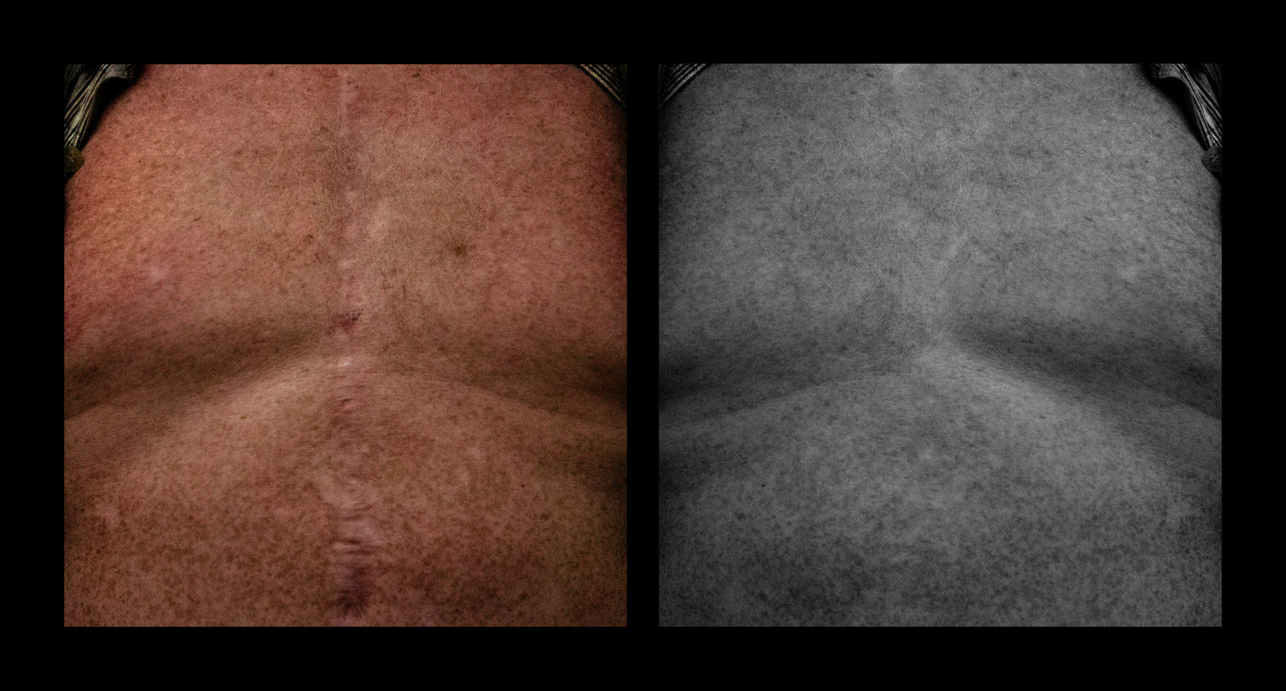  Comparative series on scars 