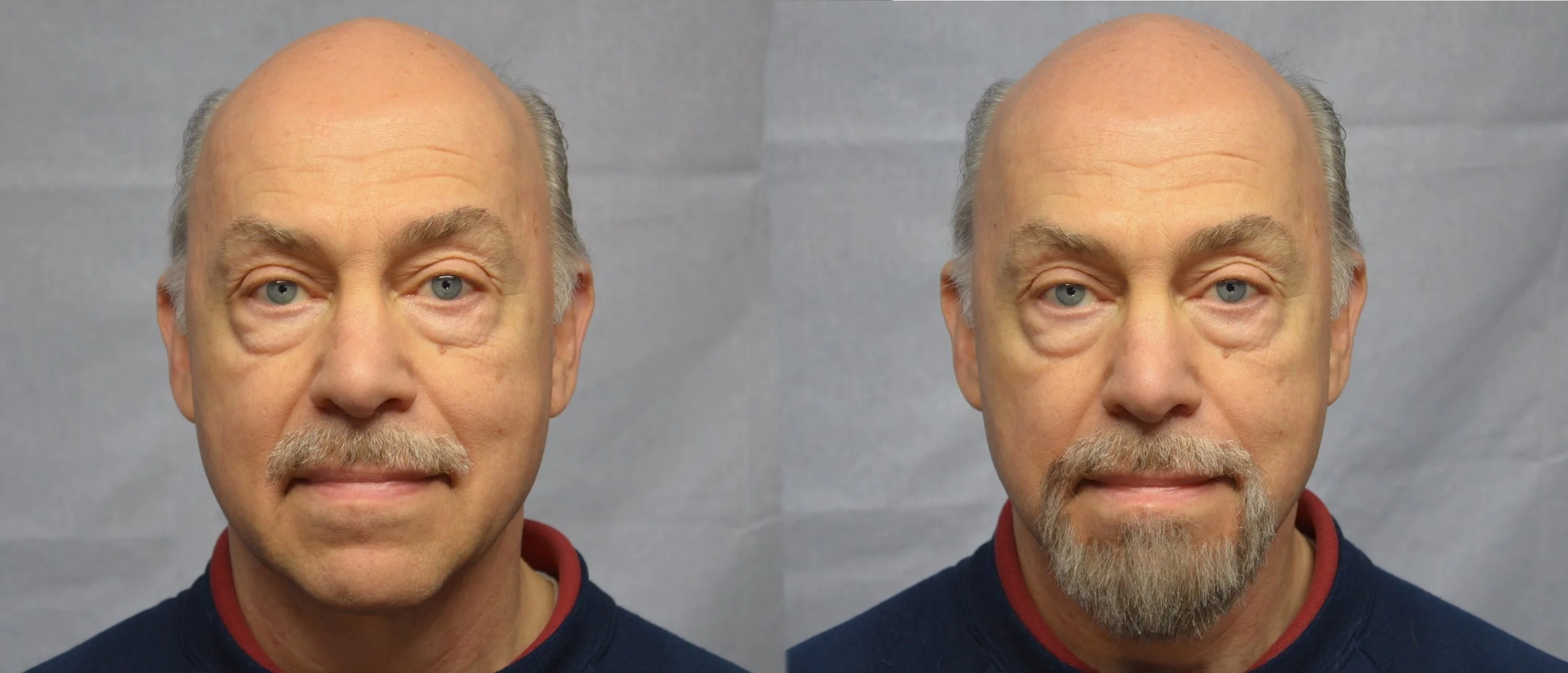  Hair Laying - Before &amp; After 