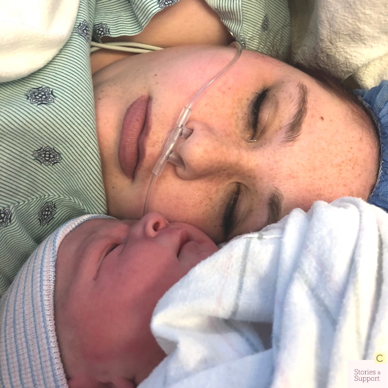 C-Section Birth Stories: Madison Hughes