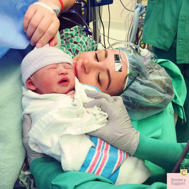 C-Section Birth Stories: Haley Erwin