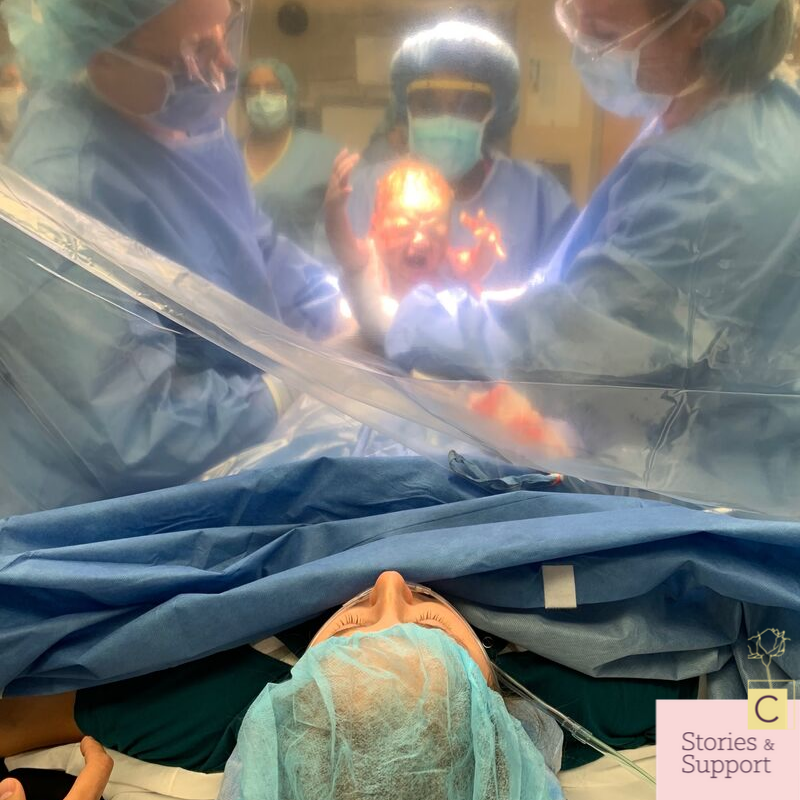 C-Section Birth Stories: Amanda Belmonte
