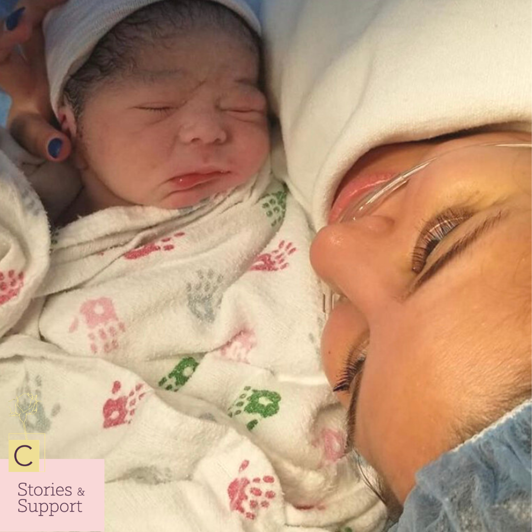 C-Section Birth Stories: Damaris Reyes