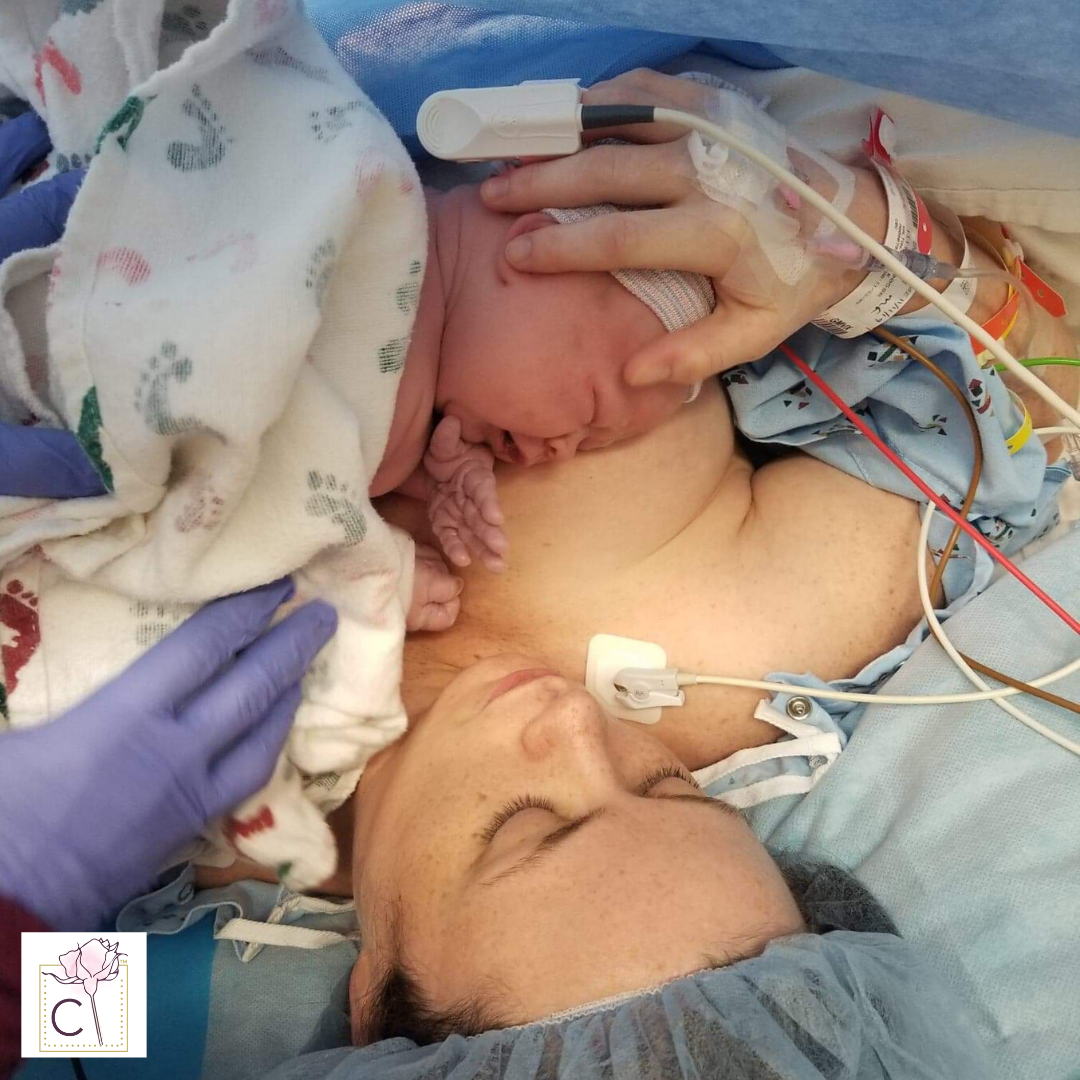 C-Section Birth Stories: Katie Walton