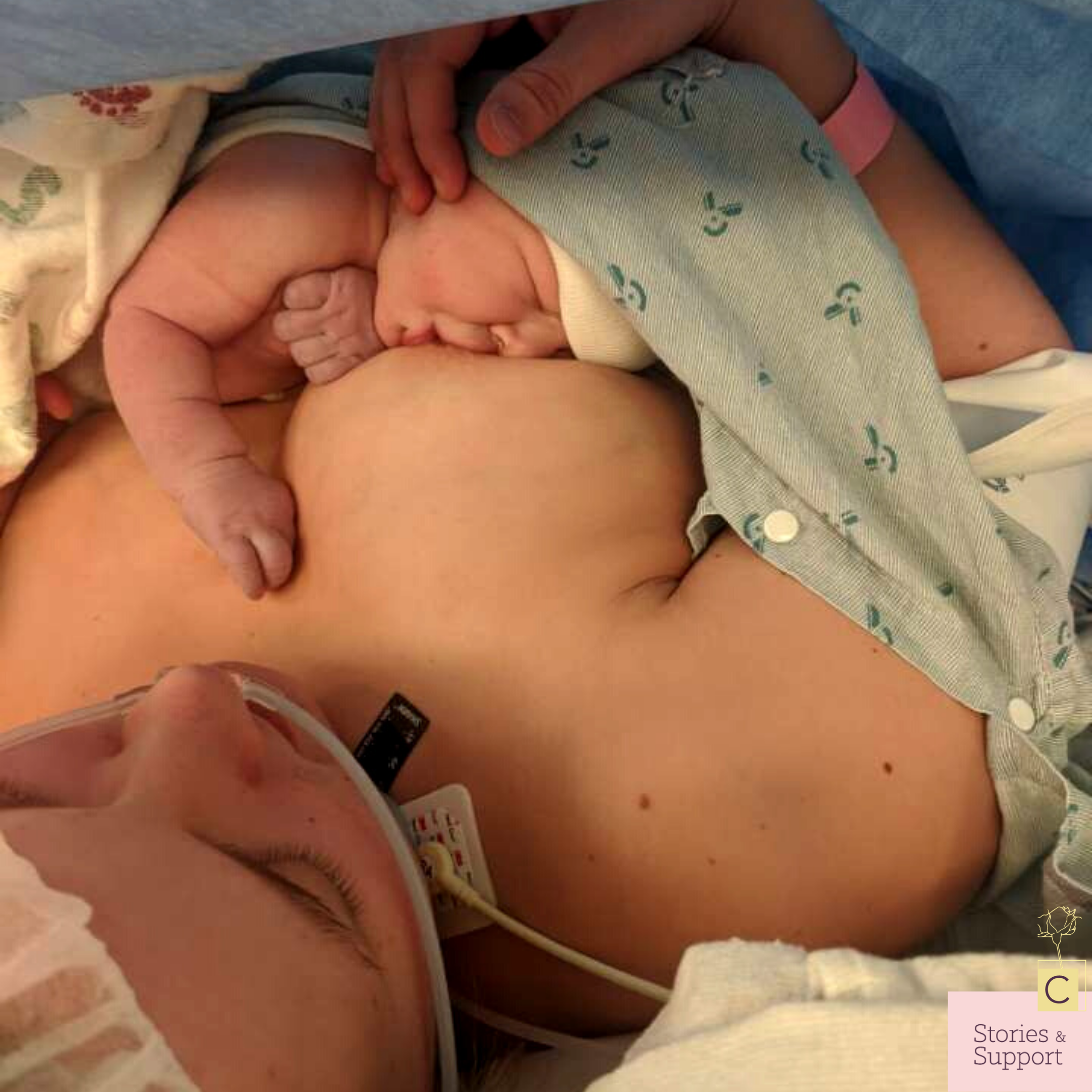 C-Section Birth Stories: Caroline Hamblin