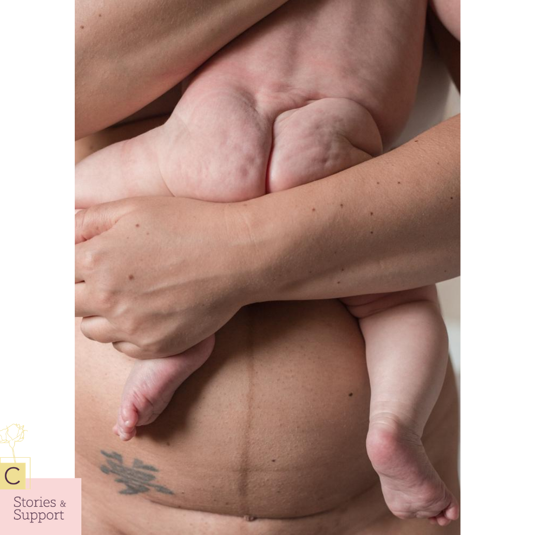 C-Section Birth Stories: Rachel Eleyet
