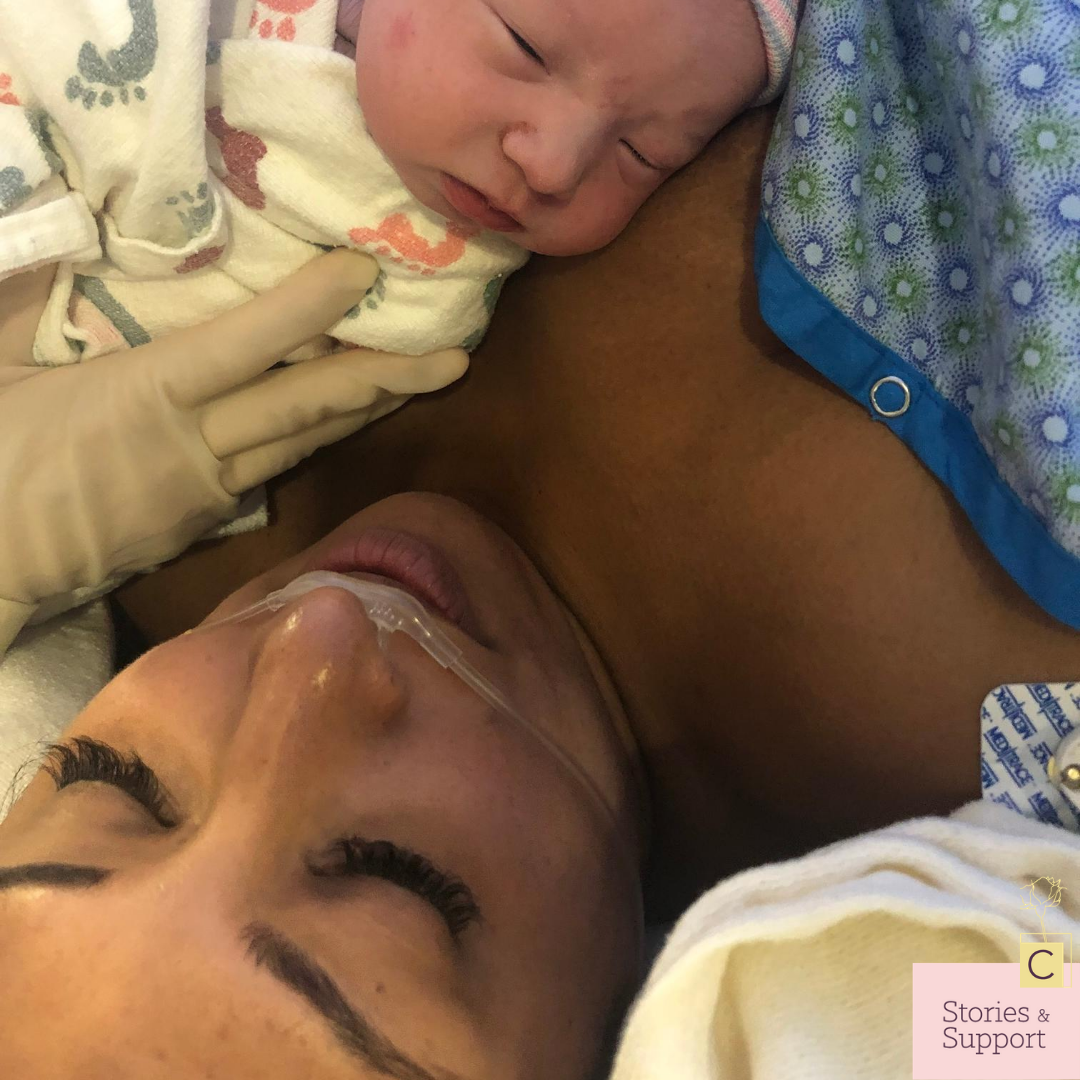 C-Section Birth Stories: Sunaina Kumar