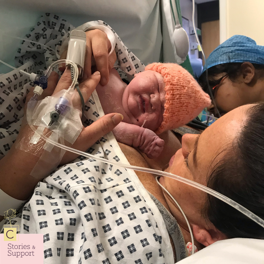 C-Section Birth Stories: Kirsty-Jo Blenkharn