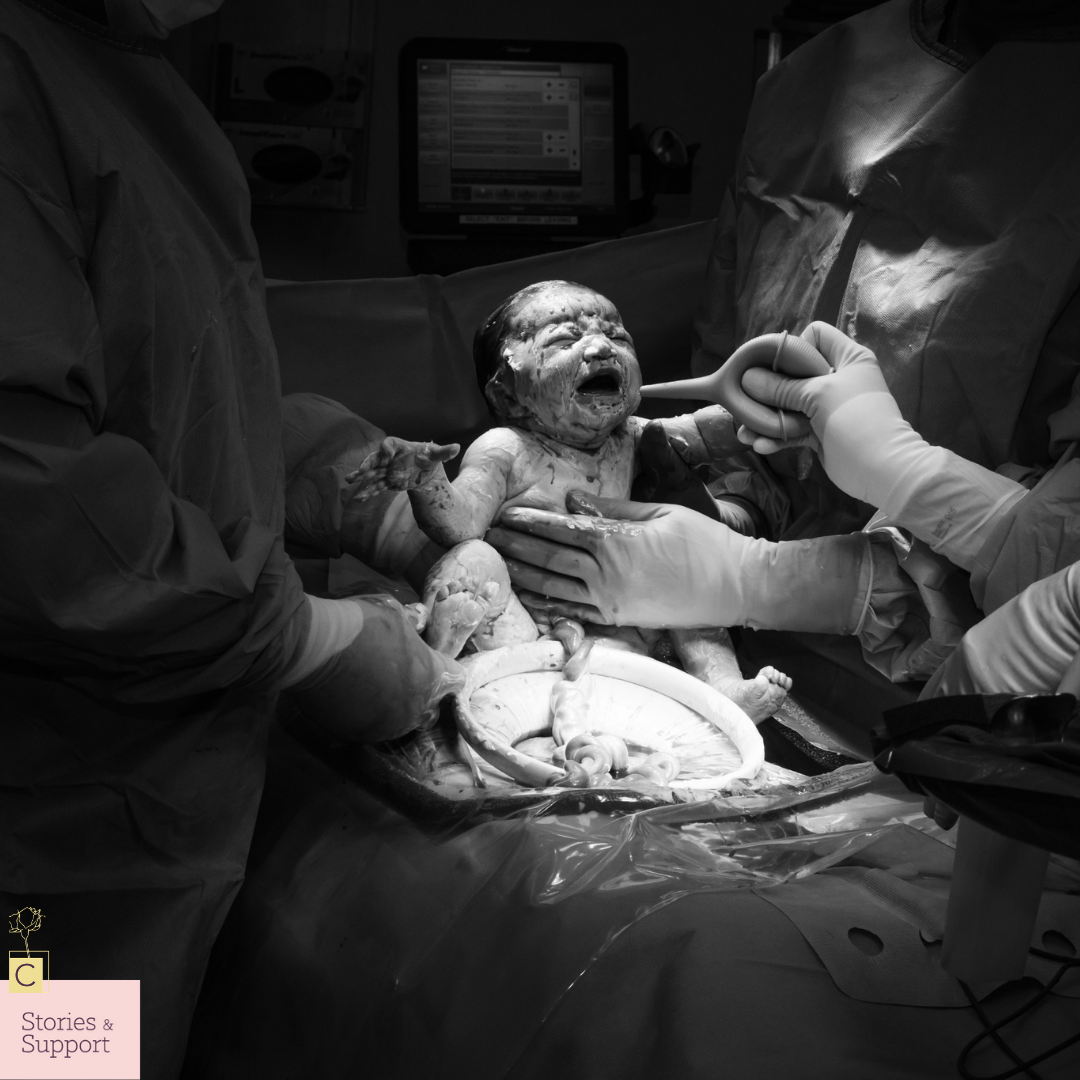 C-Section Birth Stories: Samantha Newhall