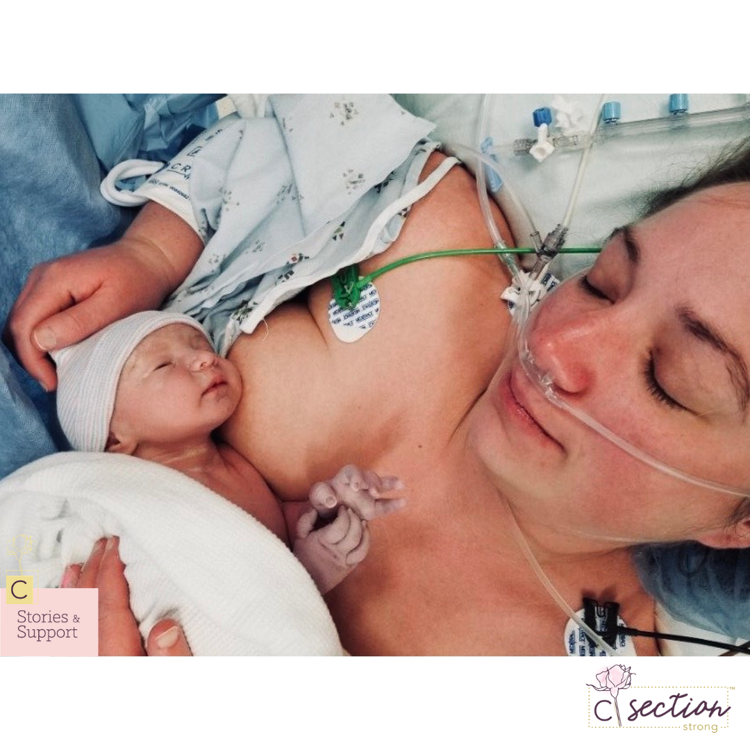 C-Section Birth Stories: Sarah Leeper