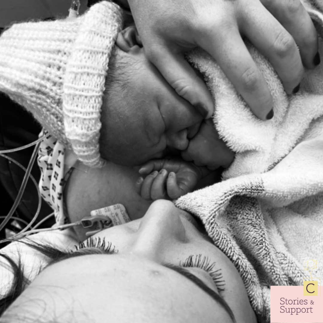 C-Section Birth Stories: Fran James