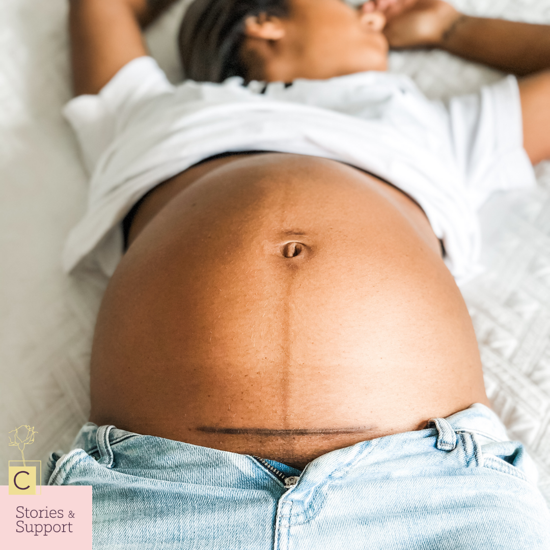 C-Section Birth Stories: Elizabeth Del Giudice