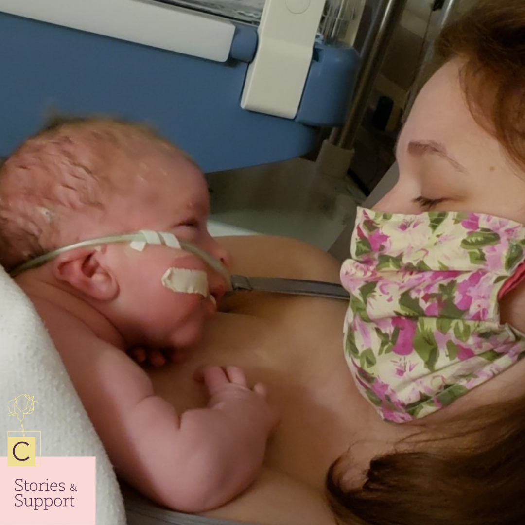 C-Section Birth Stories: Anna Banks