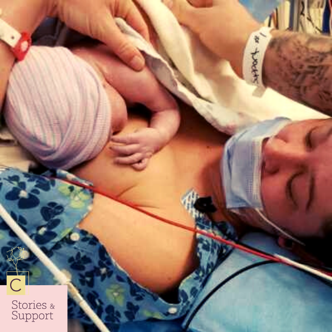 C-Section Birth Stories: Jessi Unger