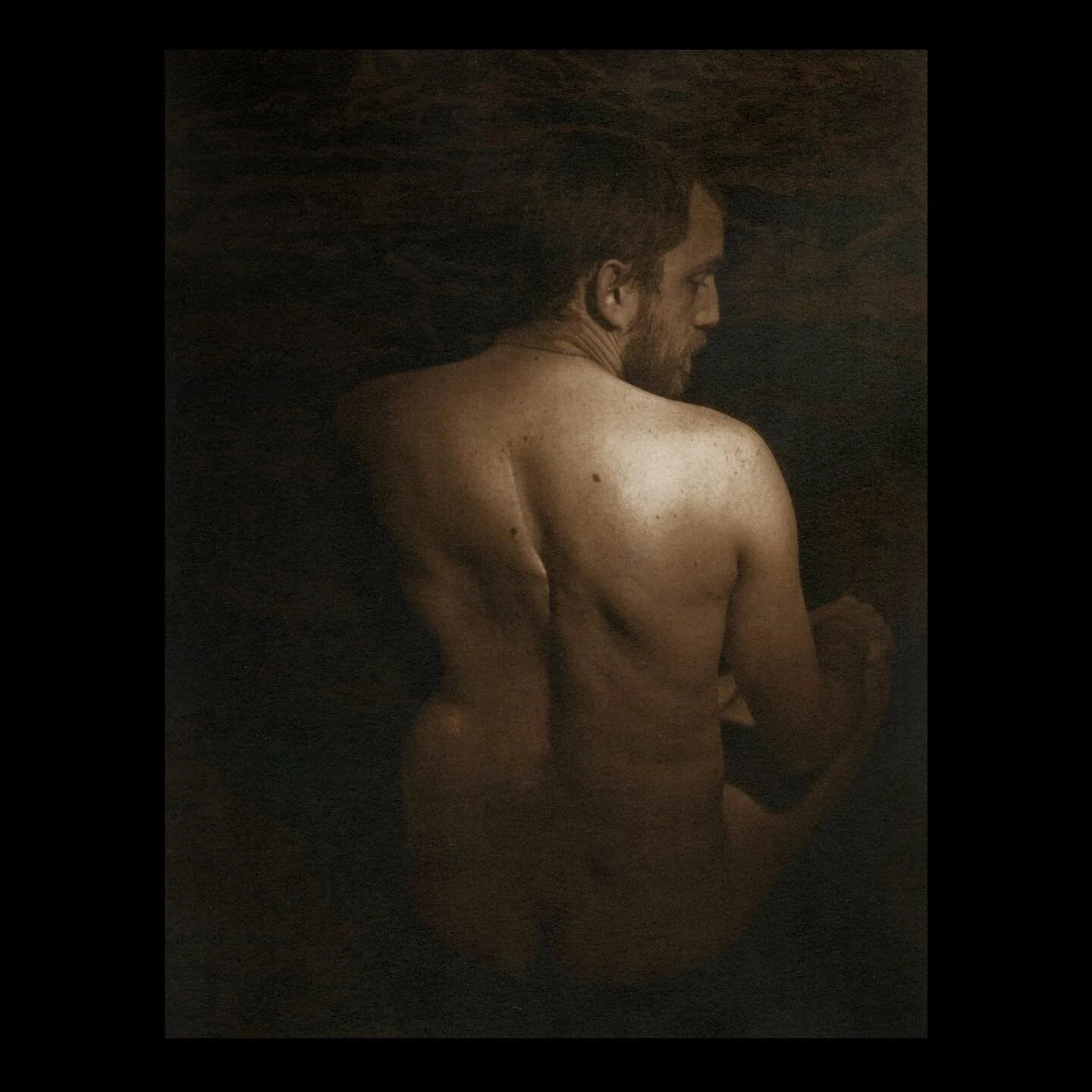 We call him Bones. There&rsquo;s a lot of reasons we tell people why, but really it was just a fortuitous happenstance of true naming. It was much later that we found out that his spinal cord had bent the titanium rod running down his back.

Another 