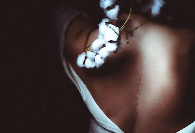 The world has not seen my scar before because of how scared I was to show it. Being vulnerable is something I have learned throughout the past two years that has changed the way I see myself and this scar. As my tattoo says &ldquo;bent not broken&rdq