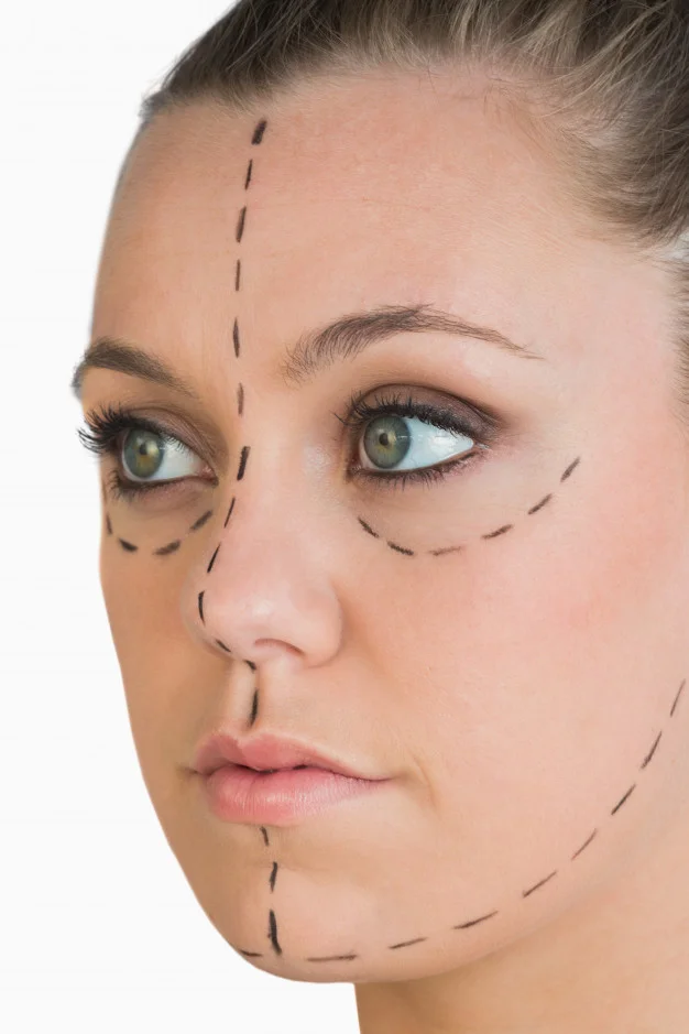 blonde-with-markings-for-a-face-lift_13339-15935.jpg