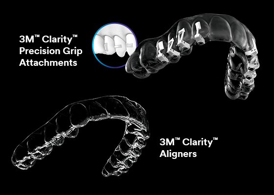 Top 10 Benefits - 3M Clarity Precision Grip aligners compared to standard aligners like Invisalign