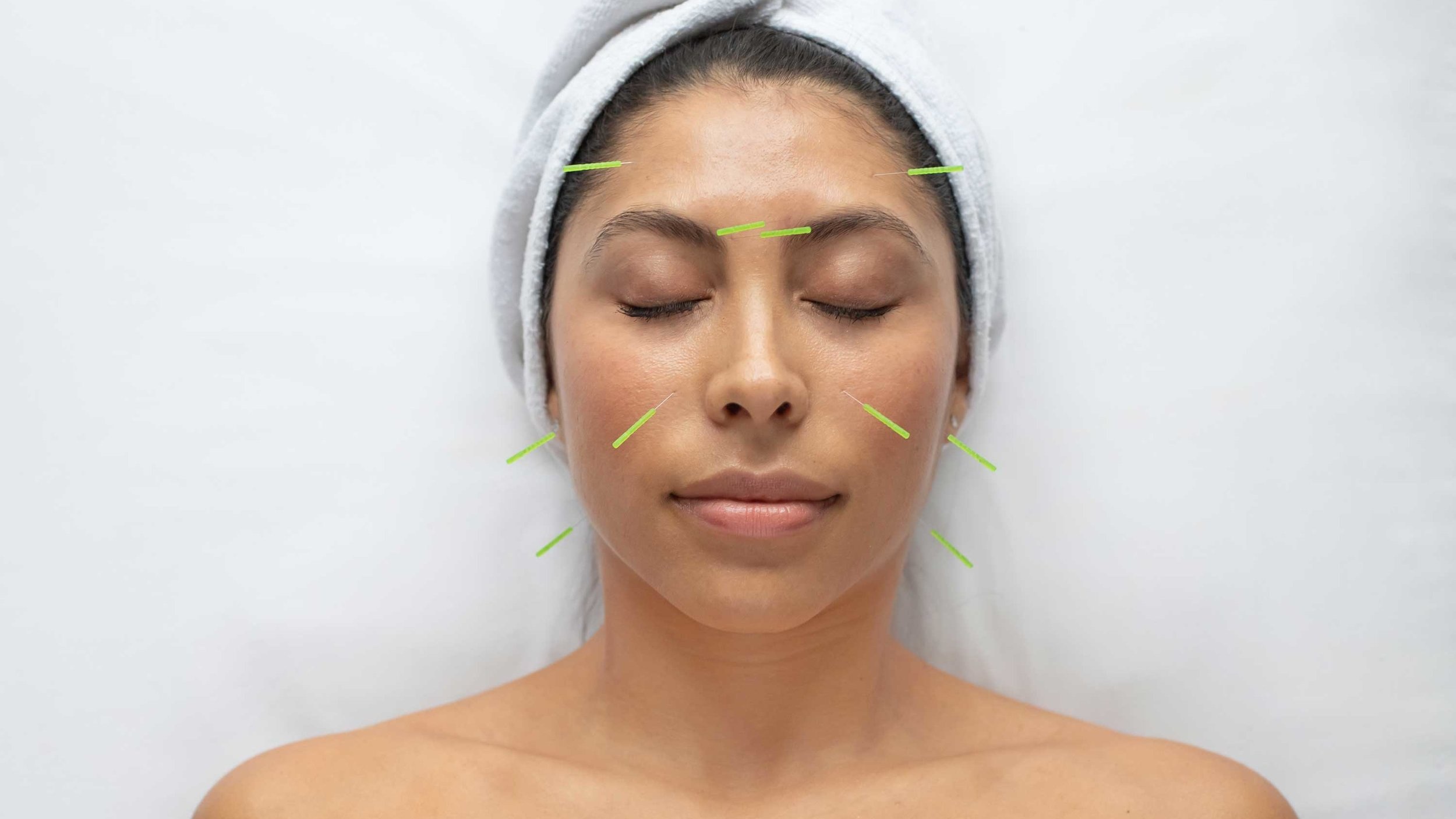 Facial Acupuncture