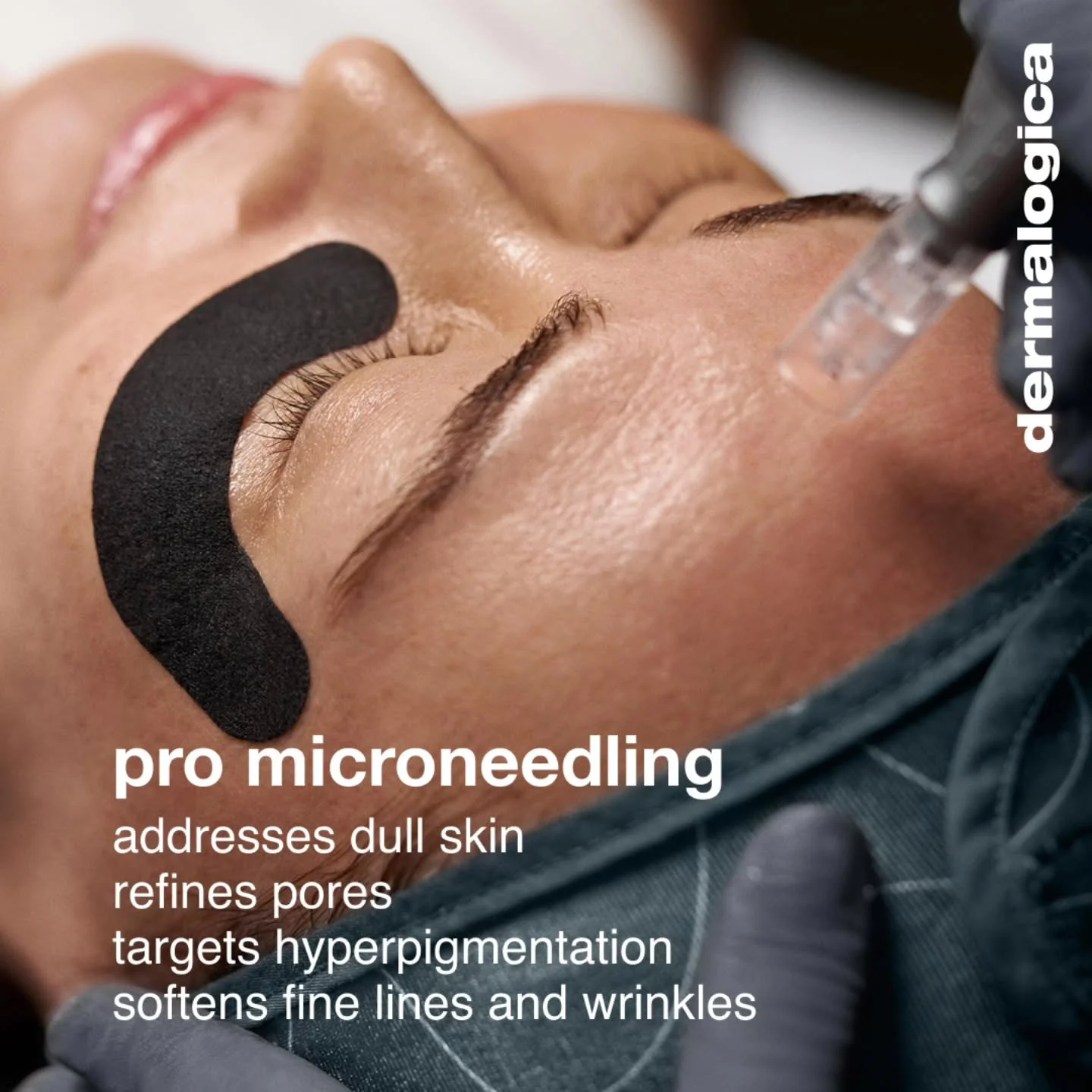 Now is the perfect time to book that microneedling appointment!

Micro injuries force your skin to rebuild - boosting collagen and elastin production. 
Great for lines and wrinkles, firmer skin, acne scars and pigmentation.

We look forward to seeing