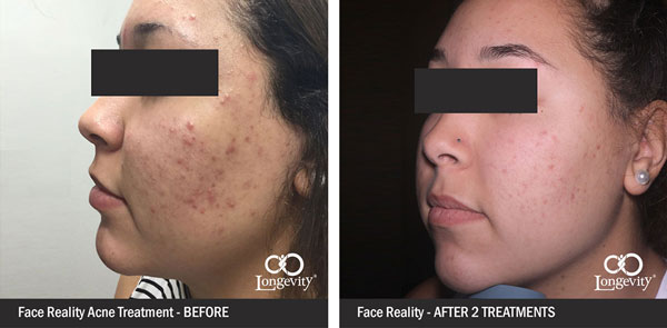 Face-Reality-Before-and-After-together-for-webpage.jpg