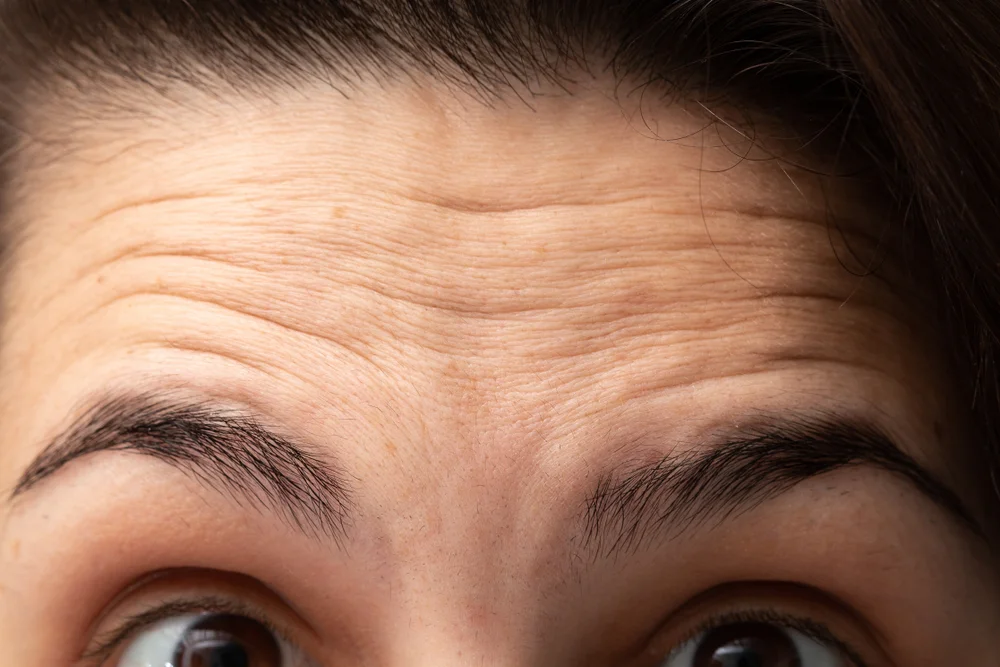 Botox in OKC.jpg