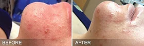 Skin Congestion