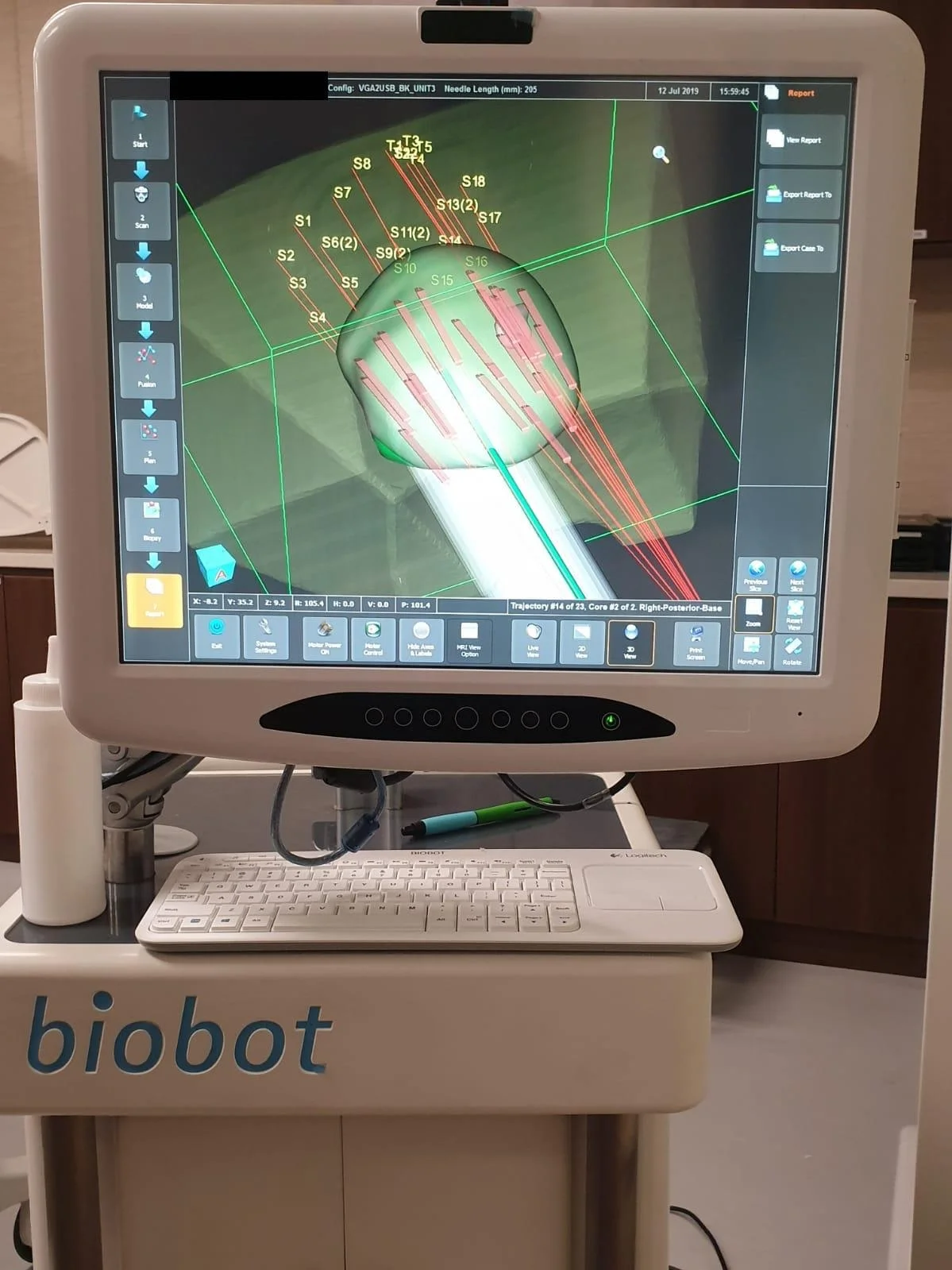 MRI-targeted robotic prostate biopsy