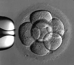 A fertilized human egg, dividing