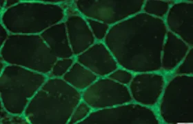 Introduction to Endothelial Progenitor Cells