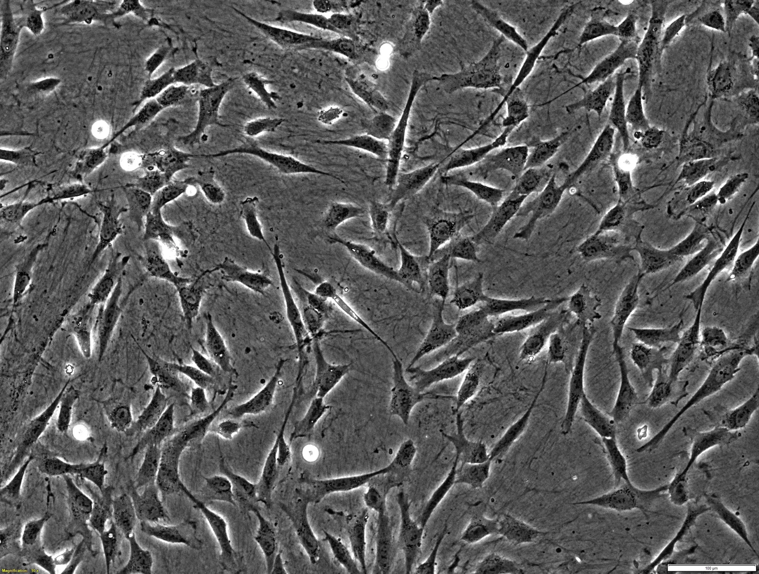 Amnion MSCs in culture on CELLvo™ Matrix (100x).