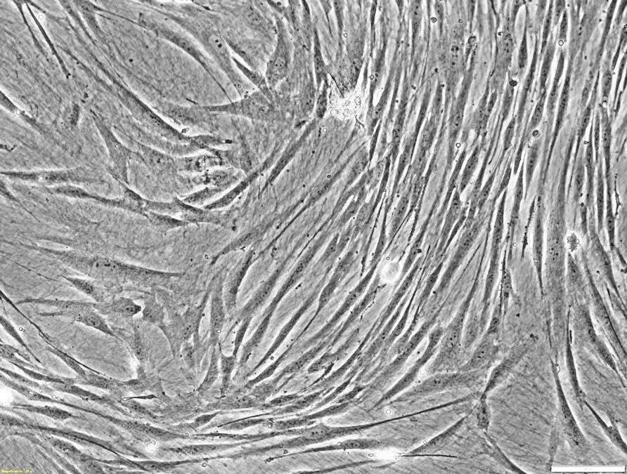 CELLvo+BM-MSC-2.jpg