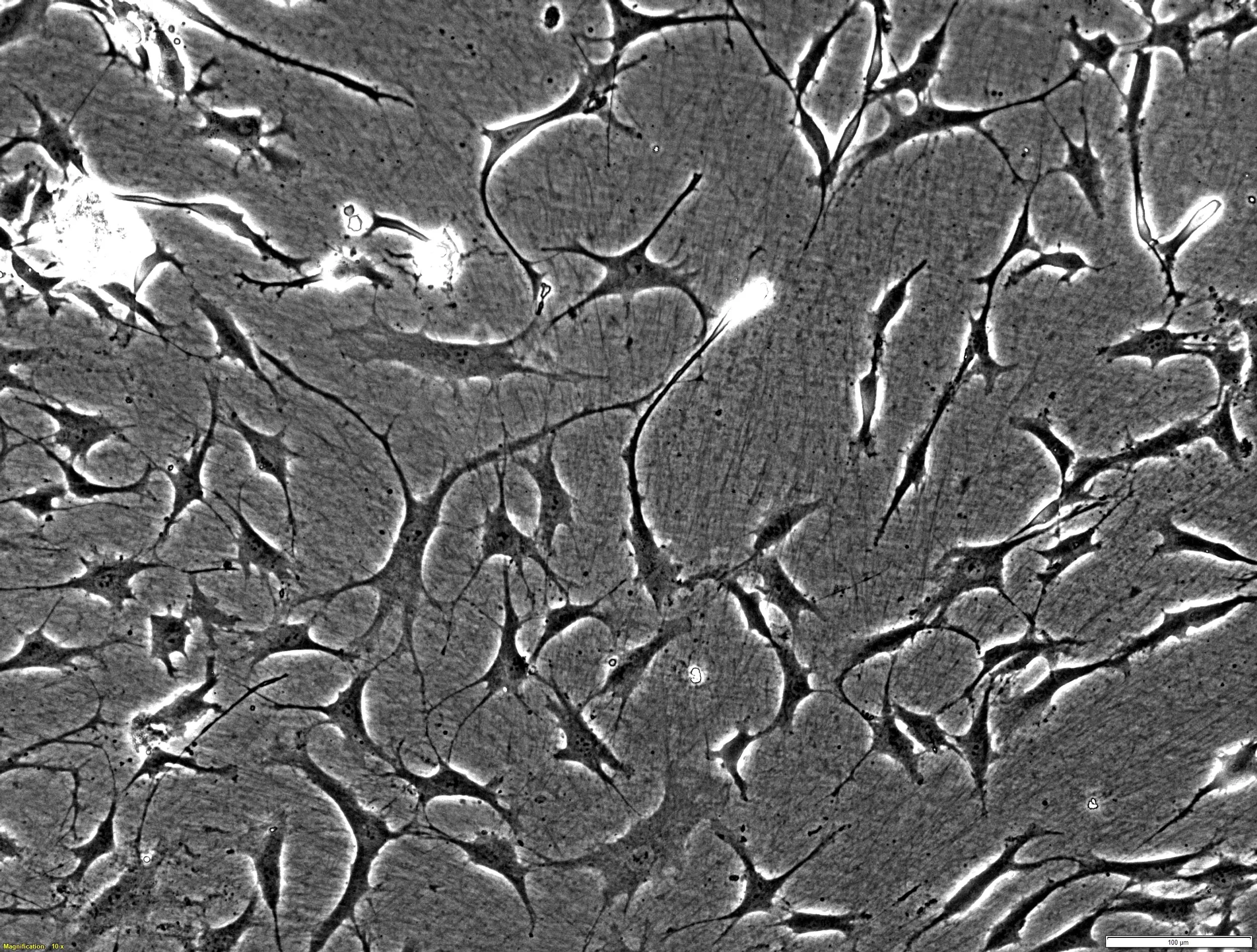 CELLvo™ Osteoarthritic Human Chondrocytes P0 (50-70y)