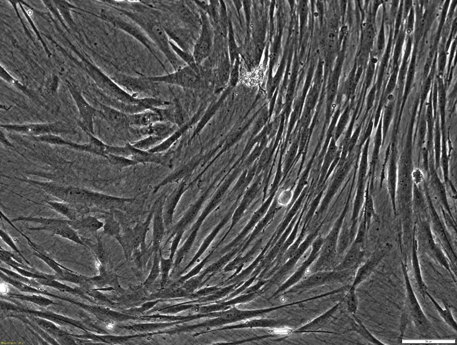 Cellvo Human Mesenchymal Stem Cells — StemBioSys®