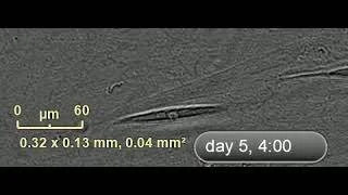 hiPSC-CM video thumbnail.jpeg