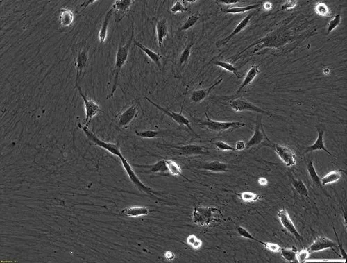 Endothelial Progenitor Cells in Human Cord Blood