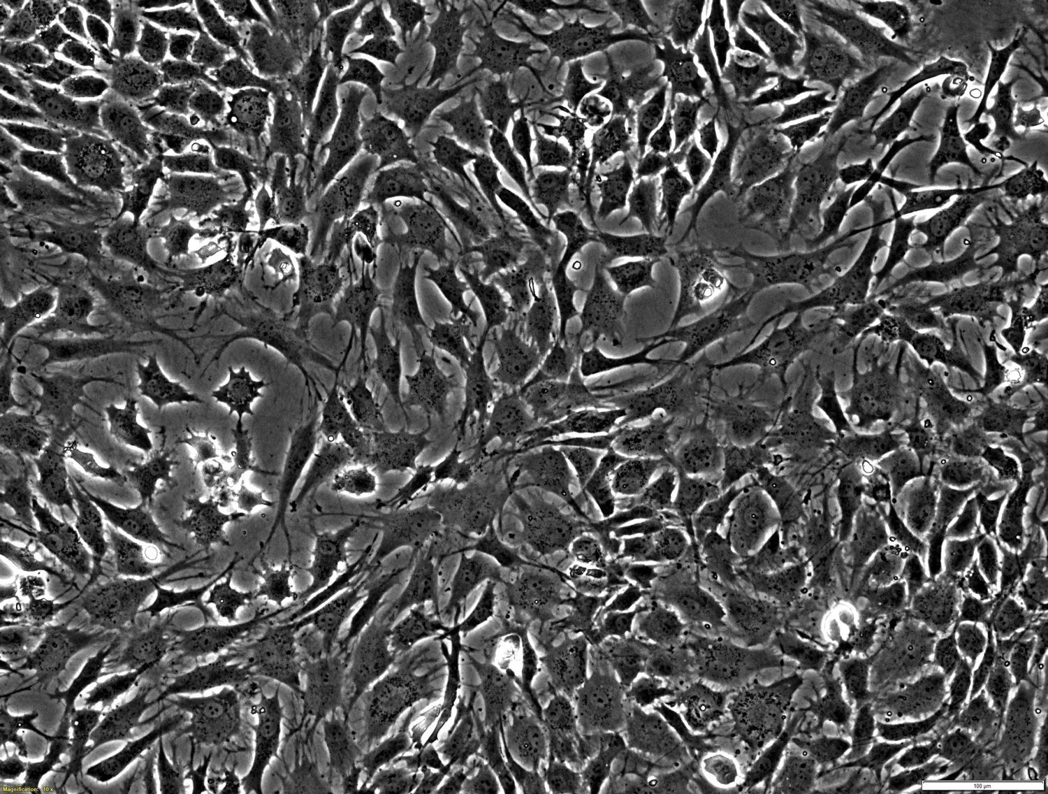 CELLvo™ ChondroMatrix for Cell-Based Articular Cartilage Therapy