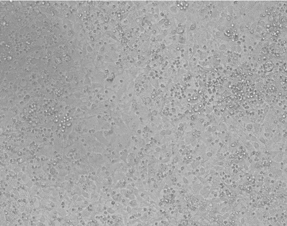 Cortical Astrocytes