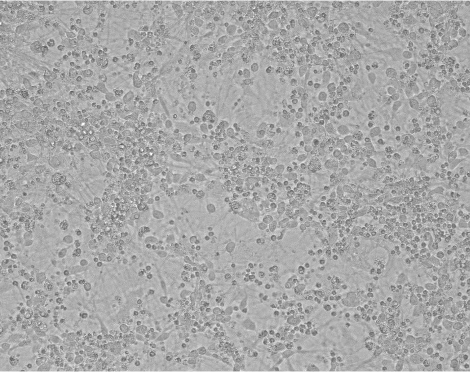 Co-culture of cortical astrocytes and cortical neurons